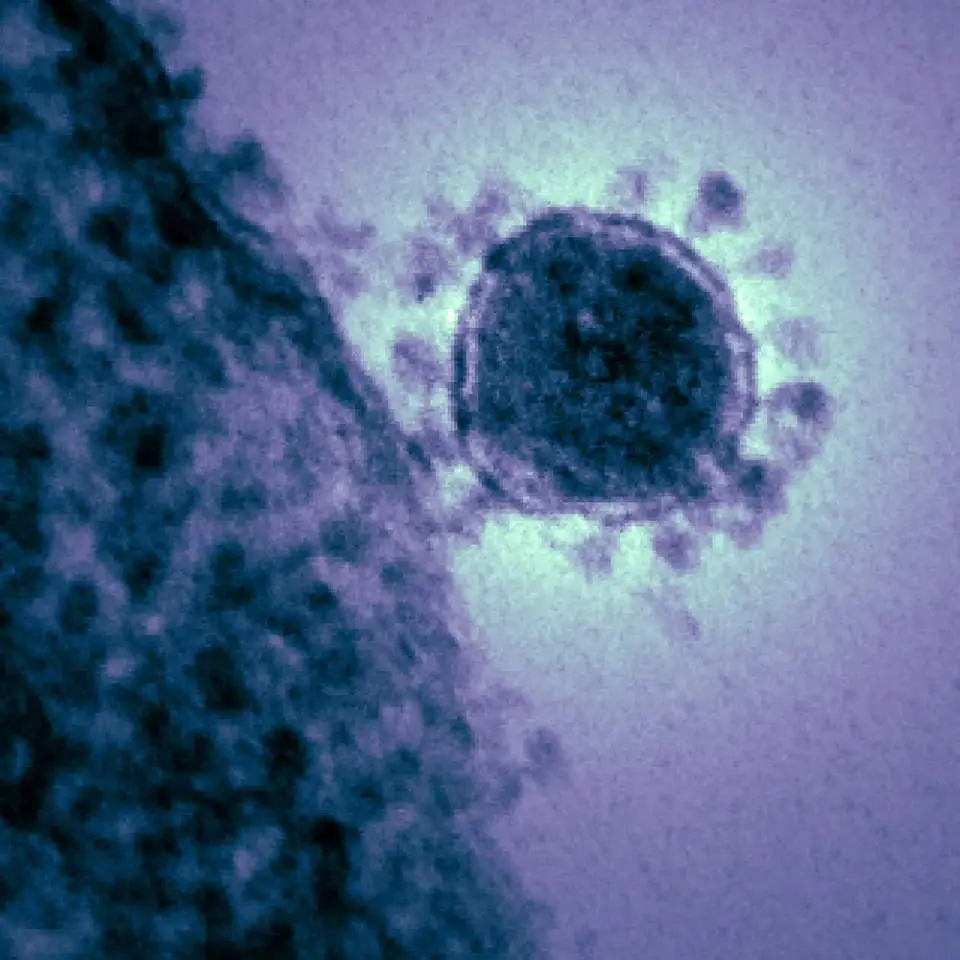 Coronavirus electron microscopic image